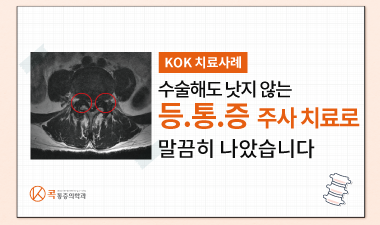  수술해도 등 통증 호전 안돼 콕에서 후관절 증후군 주사치료받은 환자사례