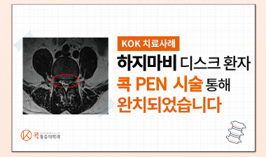 하지마비 후 콕 PEN시술 통해 호전된 디스크 환자