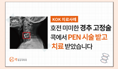 효과 못 본 디스크 수술 콕에서 PEN시술 받고 좋아졌습니다.