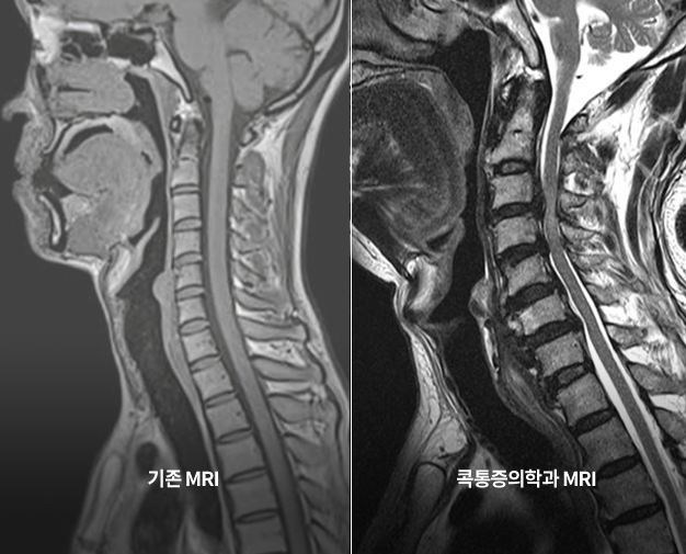 첨단 디지털 X-RAY