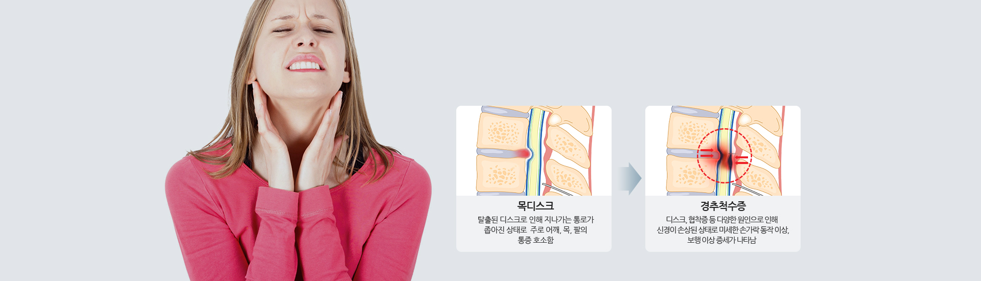 목디스크 탈출된 디스크로 인해 지나가는 통로가 좁아진 상태로 주로 어깨, 목, 팔의 통증 호소함 -> 경추척수증 디스크, 협착증 등 다양한 원인으로 인해 신경이 손상된 상태로 미세한 손가락 동작 이상, 보행 이상 증세가 나타남